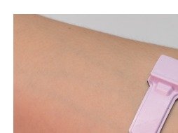Device on forearm